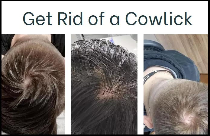cowlick hair